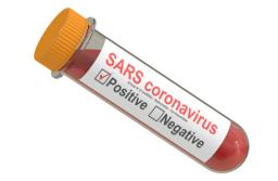 Sanepid nie może odmówić zrobienia testu na koronawirusa