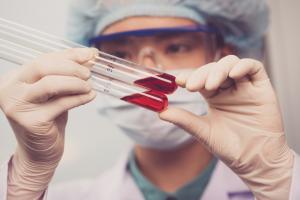 Ministerstwo Zdrowia: badanie tzw. żywej kropli krwi to nie metoda lecznicza