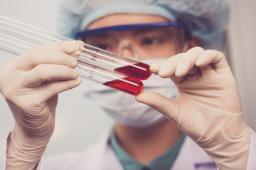 Hematolog: nie można lekceważyć regularnego wykonywania badania krwi