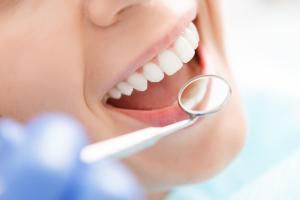 Rosja: dentystka usunęła pacjentce 22 zdrowe zęby