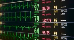 Wejherowo: będą nowe kardiomonitory dla szpitala
