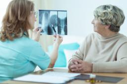 Projekt zarządzenia NFZ: zmiany w radioterapii i ortopedii