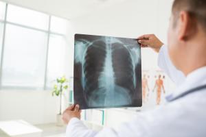 Błędy medyczne przez zaniedbania radiologów