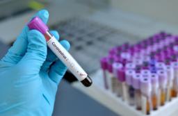 W Unii Europejskiej ruszą pracę nad szczepionką przeciwko koronawirusowi