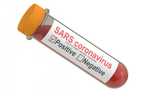 Sanepid nie może odmówić zrobienia testu na koronawirusa