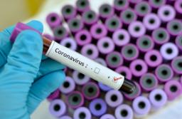 ZNP i samorządowcy apelują o szybkie i bezpłatne testy na koronawirusa dla nauczycieli i pracowników oświaty 