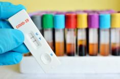 Fiskus domaga się podatku od testu na koronawirusa