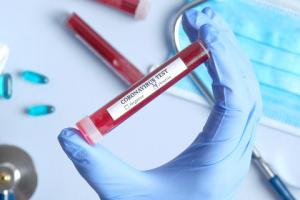 Laboratoria będą nadal mogły zatrudniać specjalistów z różnych branż