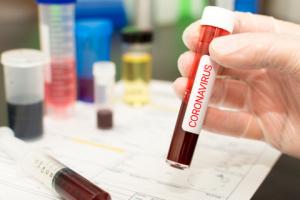MZ nie wyklucza modyfikacji systemu zlecania testów na koronawirusa