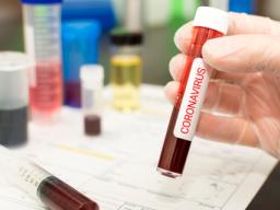 MZ nie wyklucza modyfikacji systemu zlecania testów na koronawirusa