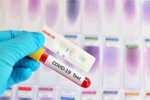 Lekarze rodzinni chcą większej autonomii w testach na COVID-19