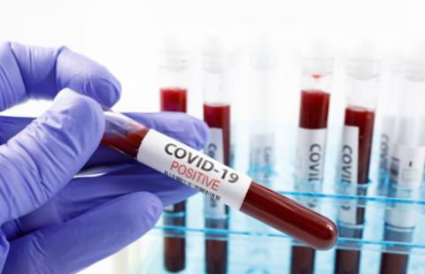 Jest projekt o standardach opieki nad pacjentami i podejrzanymi o zakażenie COVID-19