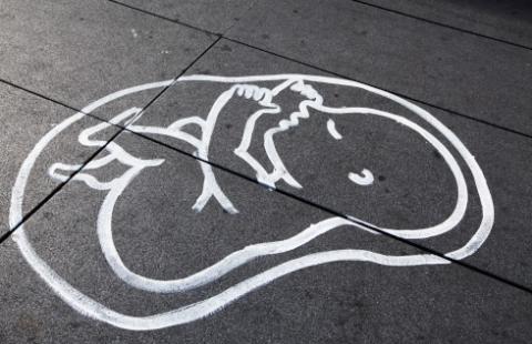 Prokuratura okręgowa nadgorliwa w sprawie aborcji - Prokuratura Krajowa zwraca jej uwagę