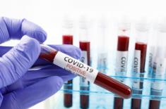 Jest podstawa do badań przesiewowych na Covid-19, ale to ryzykowna metoda