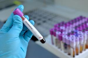 Samorząd diagnostów laboratoryjnych domaga się zmian w ustawie