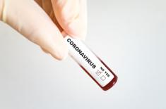 Test na Covid-19 można zlecić sobie... samemu