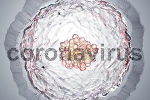 MZ: W Polsce zmarło ponad 110 tys. osób z COVID-19, w tym 304 lekarzy i 257 pielęgniarek