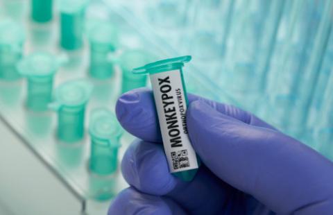 Małpia ospa dotarła do Polski - jest pierwszy przypadek