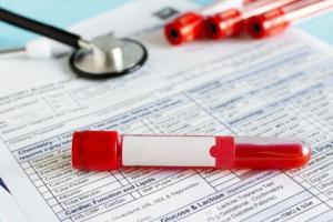 Roszady na ostatnią chwilę - pacjenci obawiają się o kontynuację leczenia