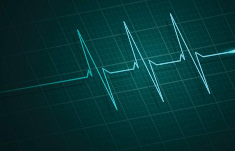 Monitorowanie EKG z domu pacjenta - projekt pilotażu trafił do konsultacji 