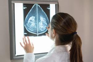 Rak piersi - na co może liczyć pacjent w ramach NFZ