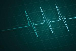 Nowe świadczenie gwarantowane dla pacjentów z ciężką niewydolnością serca