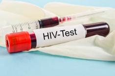 Test na HIV u lekarza podstawowej opieki? Rośnie liczba zakażonych