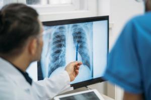 Zniesienie limitów na tomografię komputerową pomogło... na chwilę