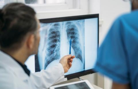 Zniesienie limitów na tomografię komputerową pomogło... na chwilę