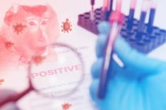 Małpia ospa na razie daleko od Polski, ale są wytyczne postępowania z chorymi