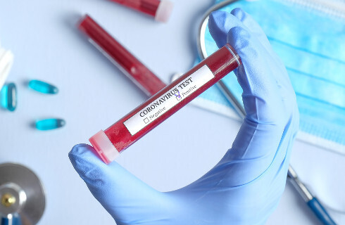 Samorząd lekarski chce uznania SARS-CoV-2 za chorobę zawodową