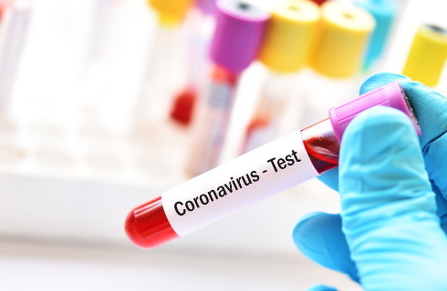 koronawirus testy