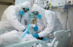 anestezjolog respirator