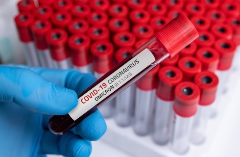 Test na Covid-19 w szpitalu już tylko wyjątkowo