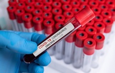 omikron koronawirus probowka