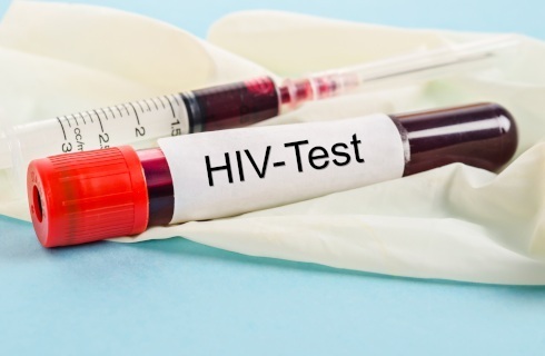 Jak lekarz ma zrobić test na HIV w POZ? Jest portal edukacyjny